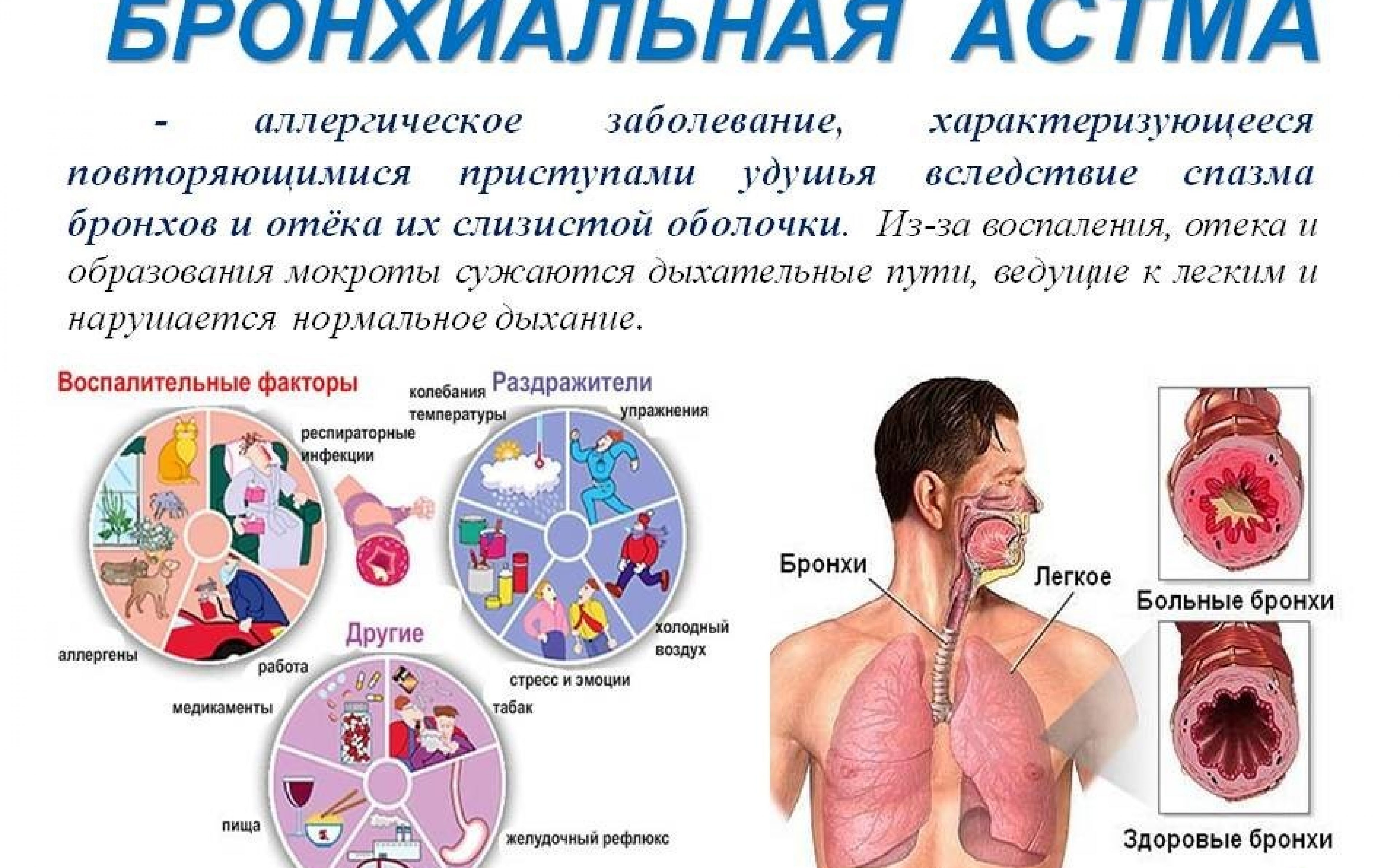 Бронхит у человека. Заболевания органов дыхания бронхиальная астма. Бронхиальная астма это заболевание. Бронхи при бронхиальной астме.